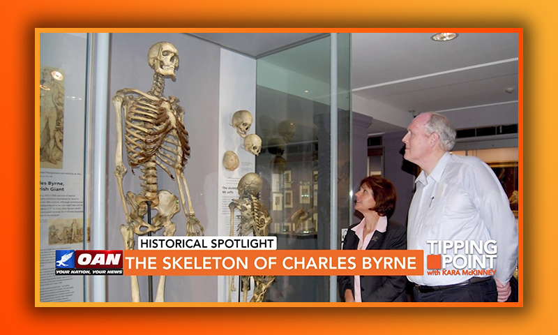 The Skeleton of Charles Byrne