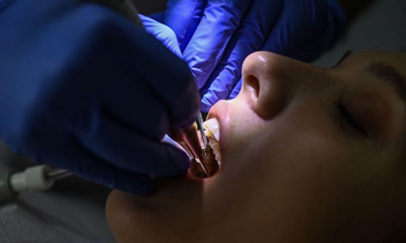 This photograph taken on September 16, 2022, shows a close-up view of a dentist working on a patient at a dental clinic in Istanbul. - Attracted by unbeatable prices, fast turnaround times and the promise of a bright smile, 150,000 to 250,000 foreign patients will travel to Turkey for treatment this year, according to the Turkish Dental Association (TDB), making the country one of the main destinations of world dental tourism. (Photo by Ozan KOSE / AFP) (Photo by OZAN KOSE/AFP via Getty Images)