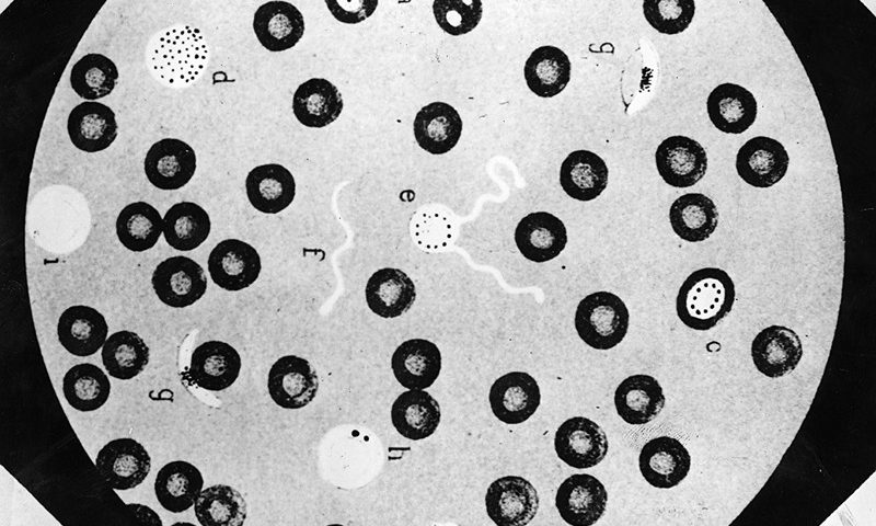 Microscopic Blood circa 1893: A view through a microscope of fresh blood, possibly infected with malaria. (Photo by Hulton Archive/Getty Images)