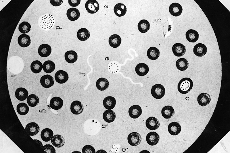 Microscopic Blood
circa 1893: A view through a microscope of fresh blood, possibly infected with malaria. (Photo by Hulton Archive/Getty Images)