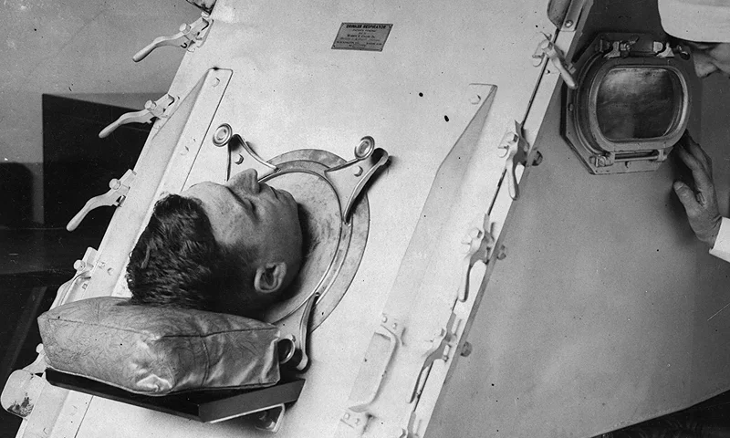 30th July 1938: A patient in an Iron Lung being checked by a nurse. (Photo by Keystone/Getty Images)